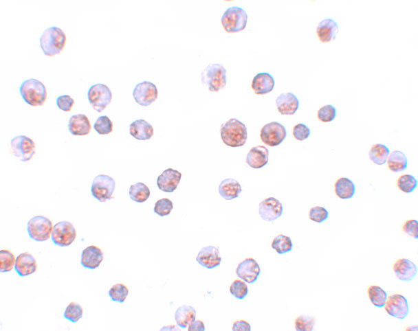 FOXO1 Antibody in Immunocytochemistry (ICC/IF)