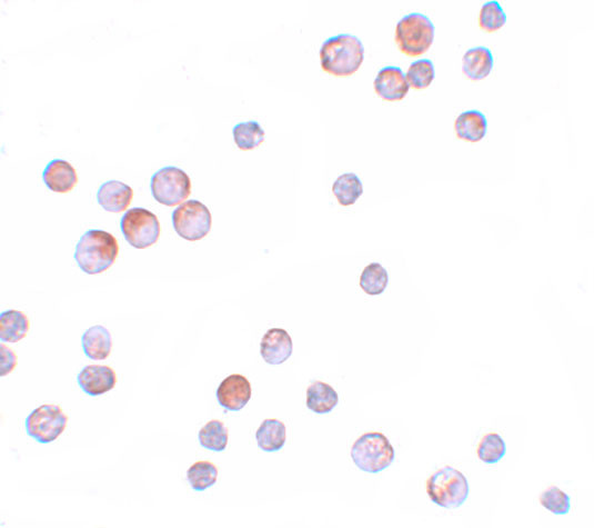 FOXO4 Antibody in Immunocytochemistry (ICC/IF)