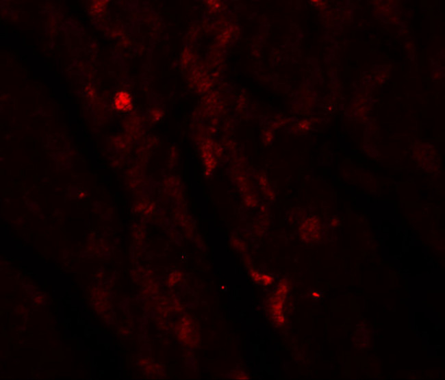 IDH2 Antibody in Immunohistochemistry (IHC)