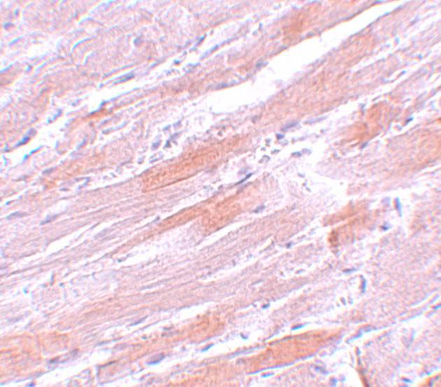 IDH2 Antibody in Immunohistochemistry (IHC)