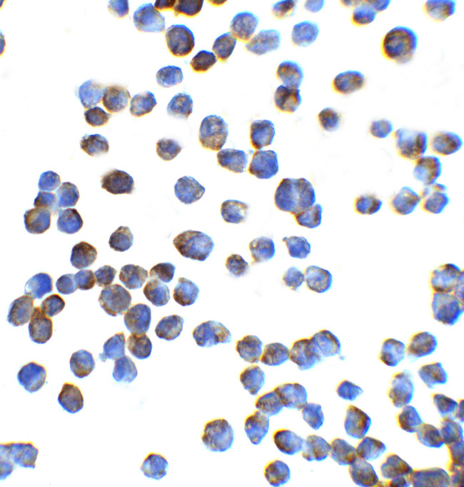 ZEB1 Antibody in Immunocytochemistry (ICC/IF)