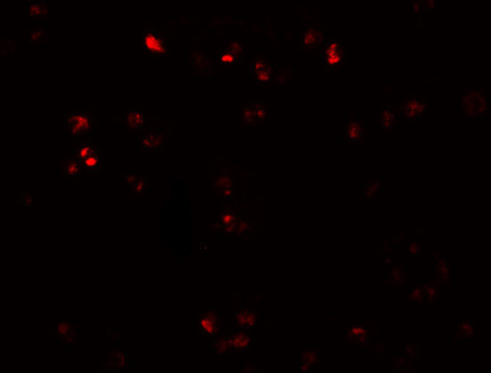 ZEB2 Antibody in Immunocytochemistry (ICC/IF)