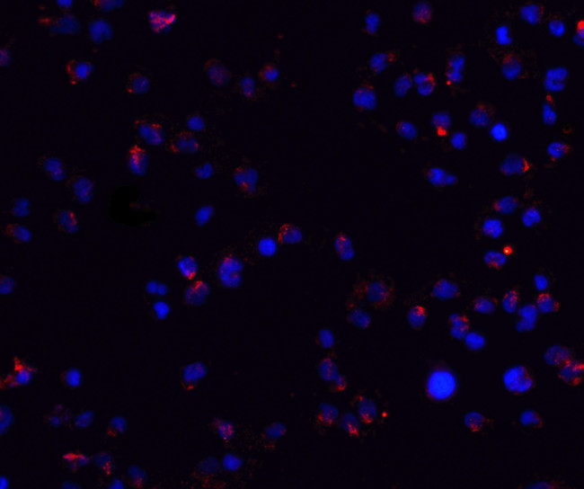 ZEB2 Antibody in Immunocytochemistry (ICC/IF)