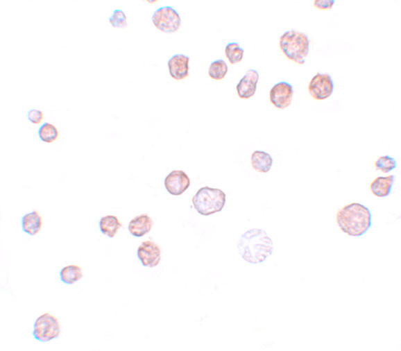 FREM1 Antibody in Immunocytochemistry (ICC/IF)