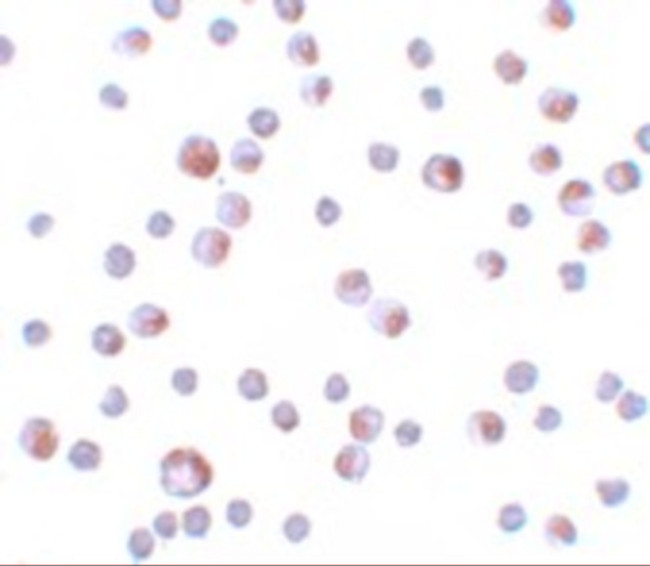 TCTN3 Antibody in Immunocytochemistry (ICC/IF)