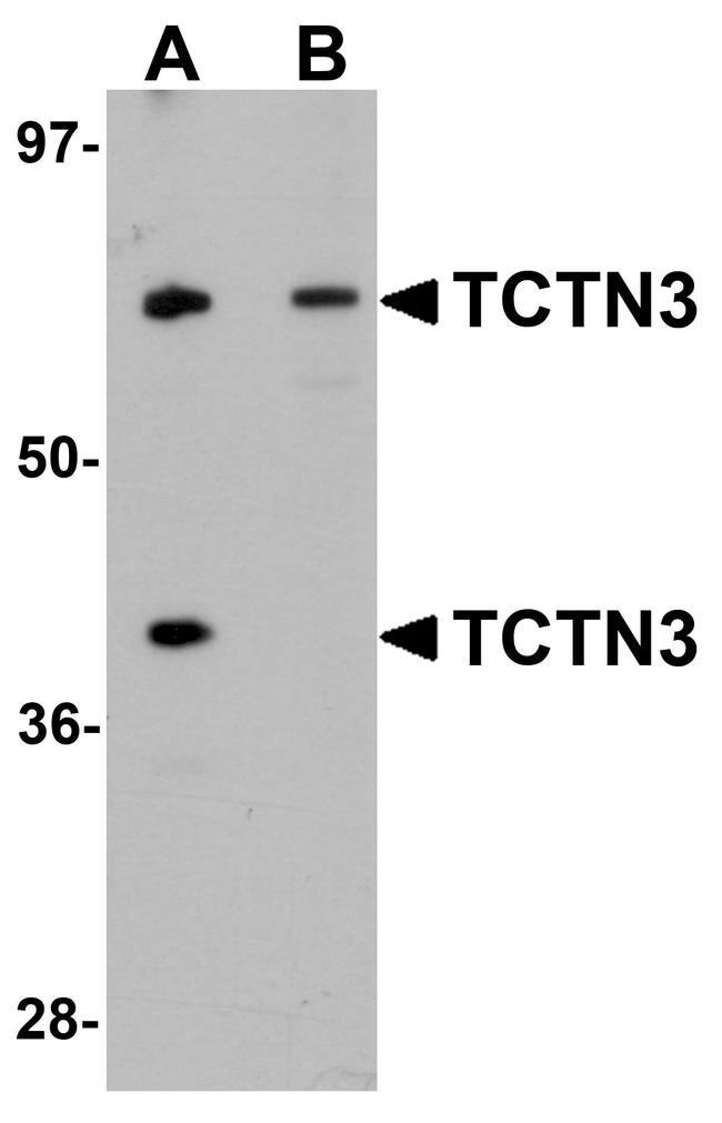 TCTN3 Antibody in Western Blot (WB)