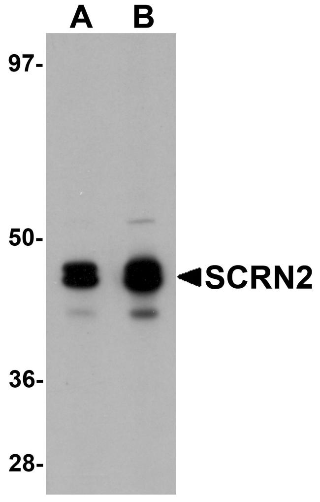 SCRN2 Antibody in Western Blot (WB)