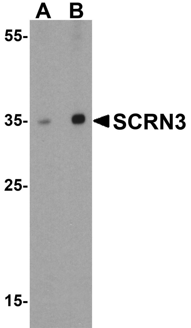 SCRN3 Antibody in Western Blot (WB)