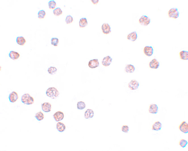 ATP11B Antibody in Immunocytochemistry (ICC/IF)