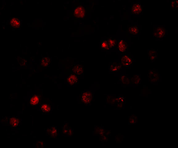 ATP11B Antibody in Immunocytochemistry (ICC/IF)