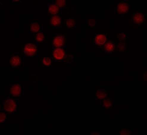 ATG9B Antibody in Immunocytochemistry (ICC/IF)