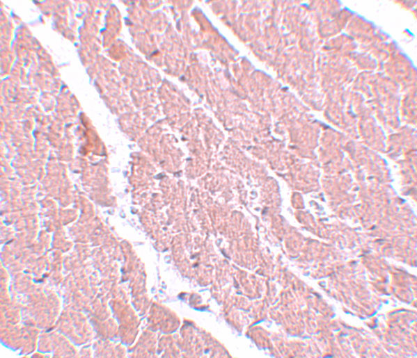 ATG13 Antibody in Immunohistochemistry (IHC)