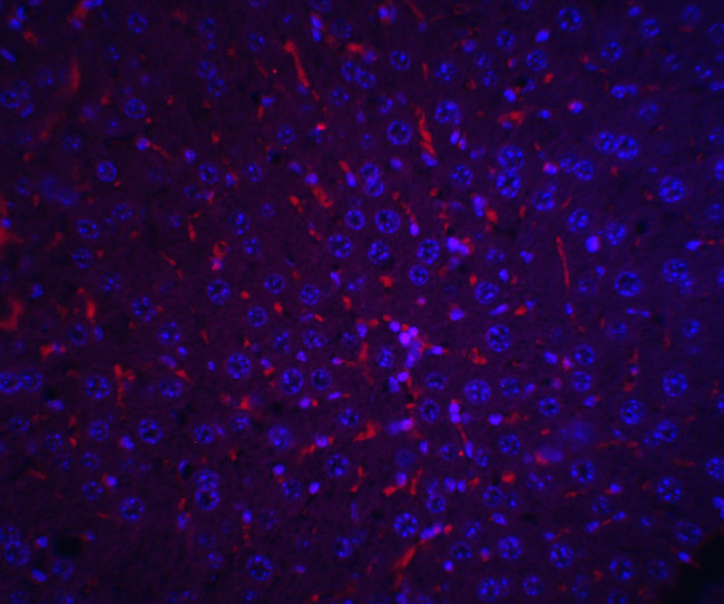 AFP Antibody in Immunohistochemistry (IHC)