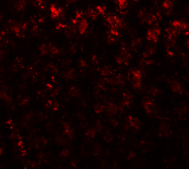 AFP Antibody in Immunohistochemistry (IHC)