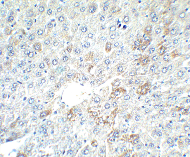 AFP Antibody in Immunohistochemistry (IHC)