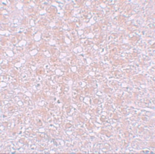AFP Antibody in Immunohistochemistry (IHC)