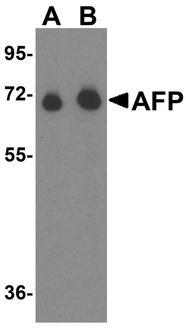 AFP Antibody in Western Blot (WB)