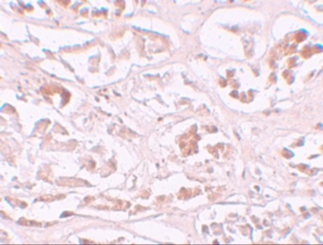 ALKBH2 Antibody in Immunohistochemistry (IHC)