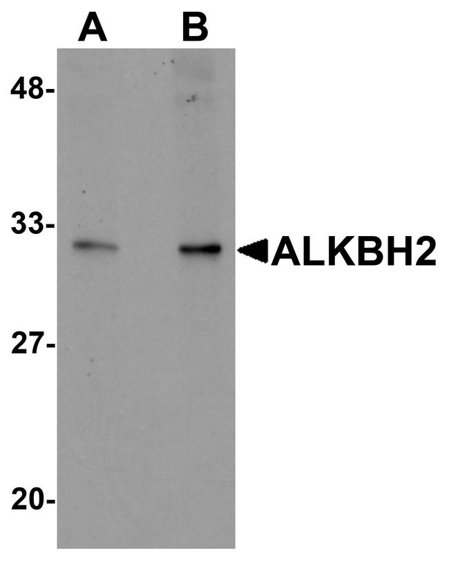 ALKBH2 Antibody in Western Blot (WB)