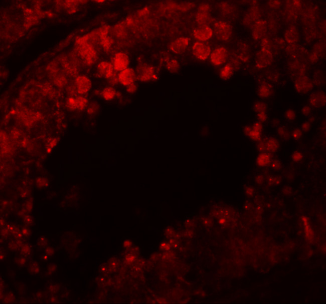 CRISP2 Antibody in Immunohistochemistry (IHC)