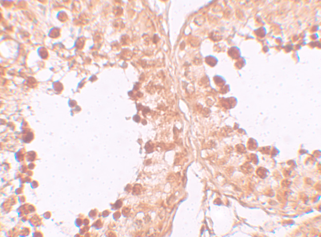 CRISP2 Antibody in Immunohistochemistry (IHC)