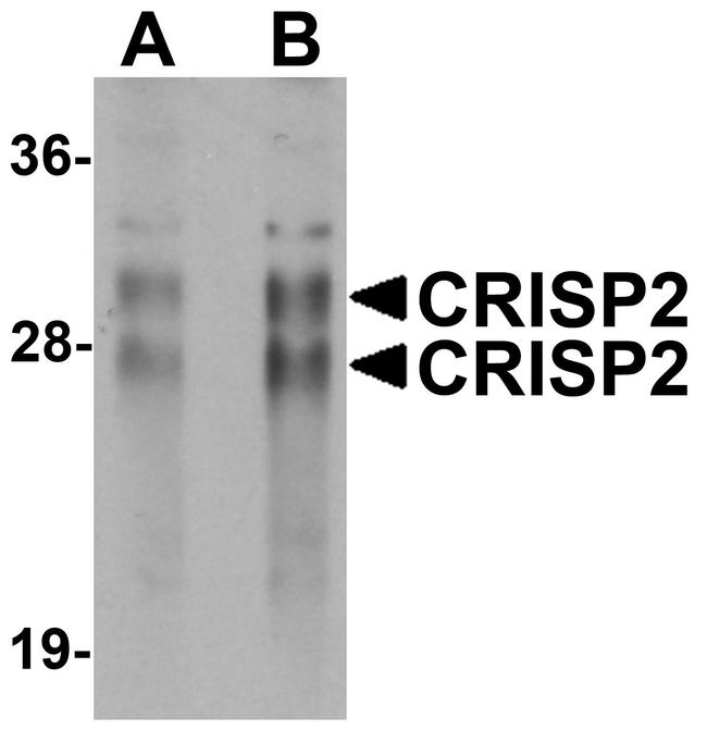 CRISP2 Antibody in Western Blot (WB)