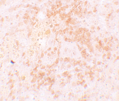 HVCN1 Antibody in Immunohistochemistry (IHC)