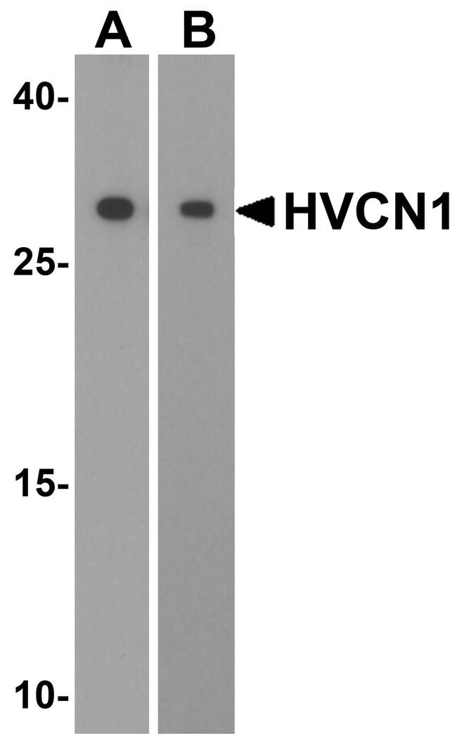 HVCN1 Antibody in Western Blot (WB)