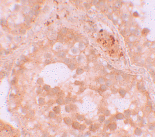 WDR92 Antibody in Immunohistochemistry (IHC)