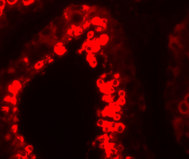 YBX2 Antibody in Immunohistochemistry (IHC)