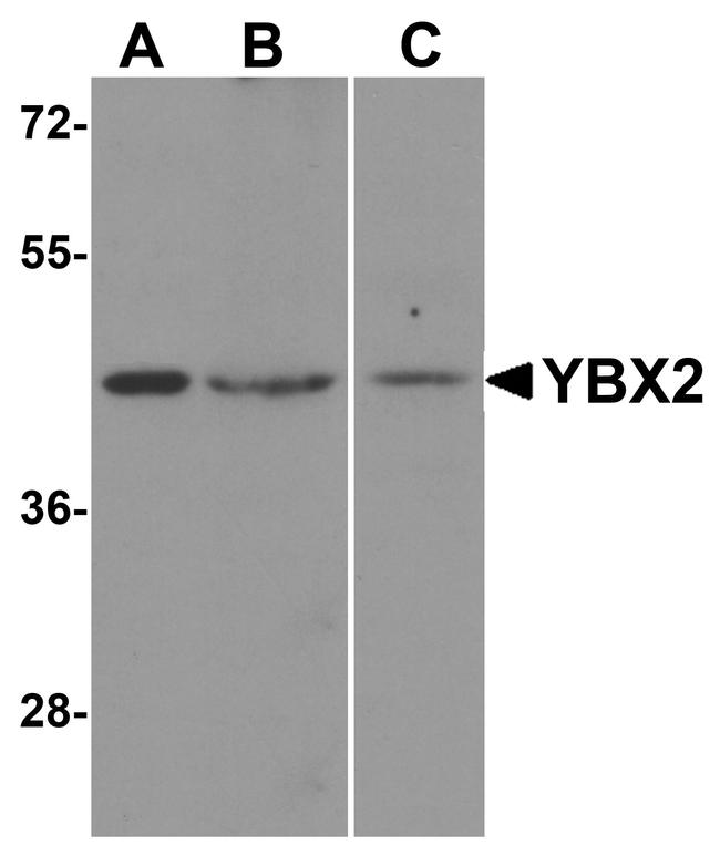 YBX2 Antibody in Western Blot (WB)