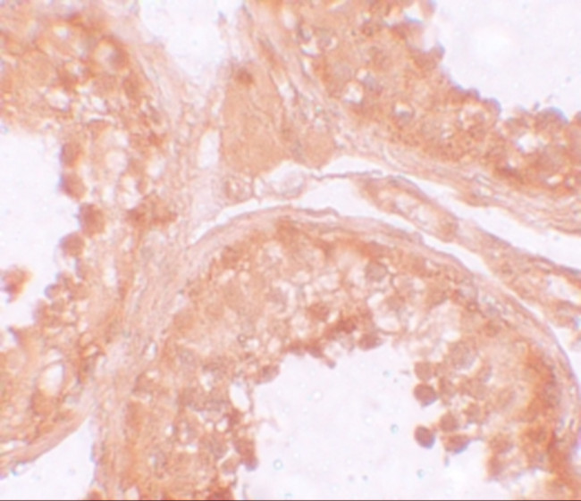 NALP9 Antibody in Immunohistochemistry (IHC)