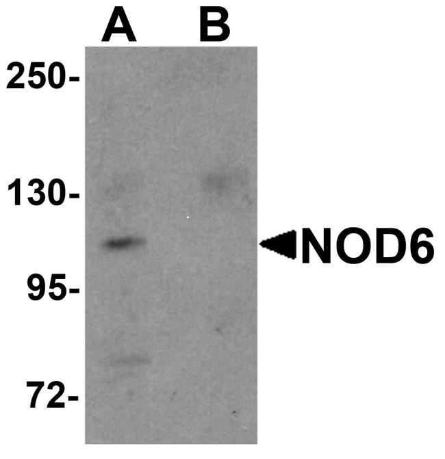 NALP9 Antibody in Western Blot (WB)