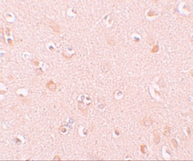 NALP5 Antibody in Immunohistochemistry (IHC)