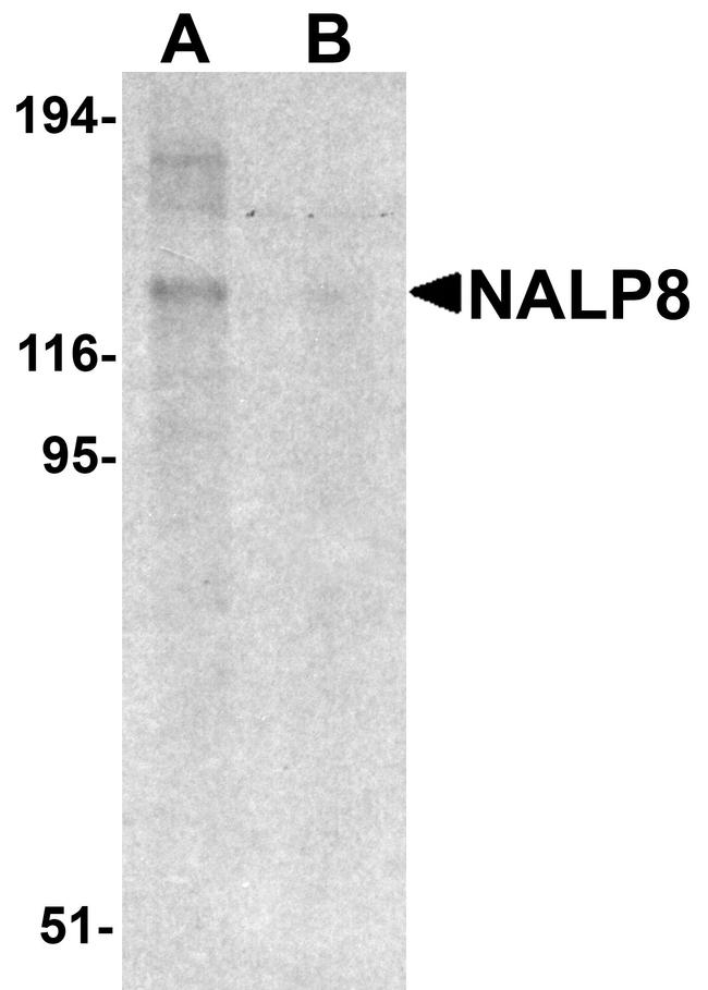 NALP8 Antibody in Western Blot (WB)