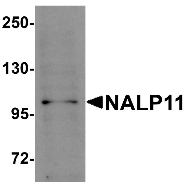 NALP11 Antibody in Western Blot (WB)