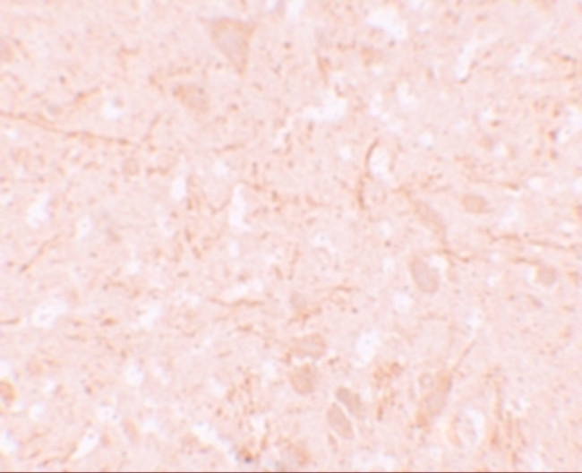 NALP12 Antibody in Immunohistochemistry (IHC)