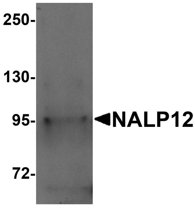 NALP12 Antibody in Western Blot (WB)