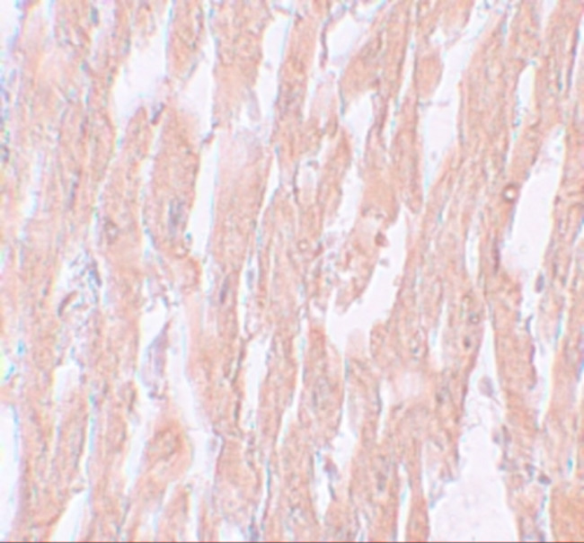 KPNA2 Antibody in Immunohistochemistry (IHC)