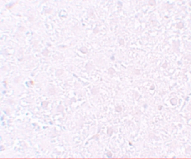 MOX1 Antibody in Immunohistochemistry (IHC)