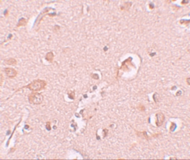 Staufen Antibody in Immunohistochemistry (IHC)