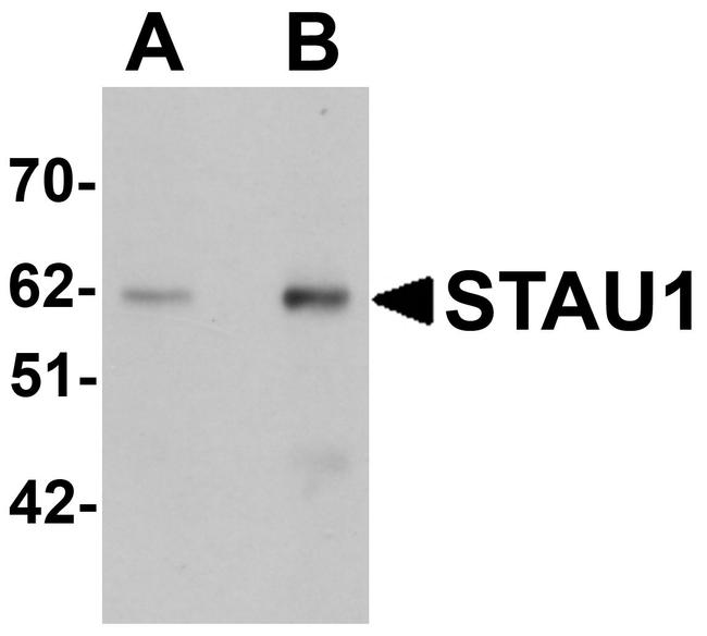 Staufen Antibody in Western Blot (WB)