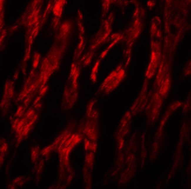 ATG9A Antibody in Immunohistochemistry (IHC)