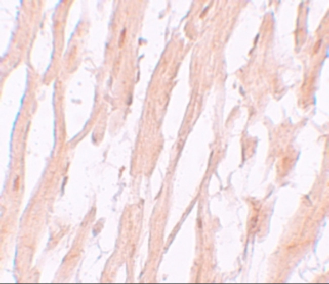 ATG9A Antibody in Immunohistochemistry (IHC)