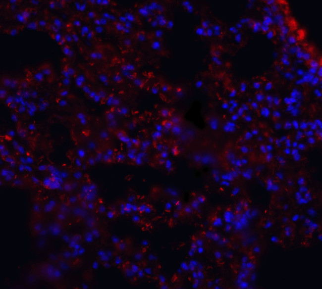 MFSD2A Antibody in Immunohistochemistry (IHC)