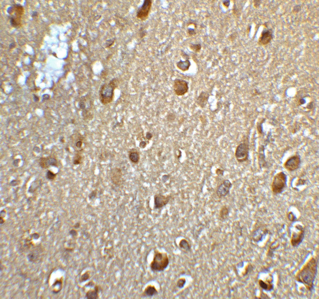 MFSD2A Antibody in Immunohistochemistry (IHC)