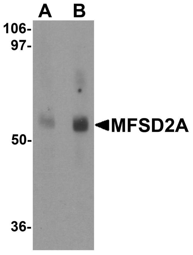 MFSD2A Antibody in Western Blot (WB)