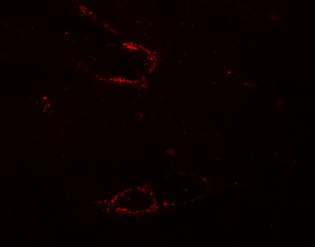 SYNPO2L Antibody in Immunohistochemistry (IHC)