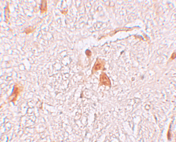 SHISA9 Antibody in Immunohistochemistry (IHC)