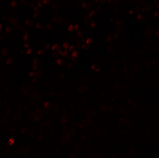 LMBRD1 Antibody in Immunohistochemistry (IHC)